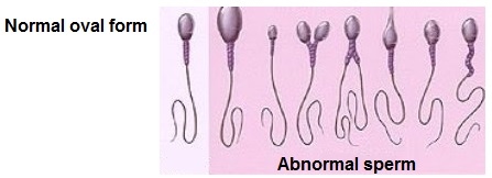 percentage abnormal sperm of Average