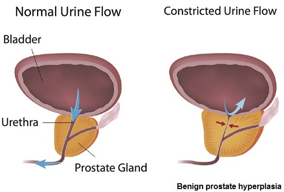 The effects of ageing on the reproductive system | The A Level ...