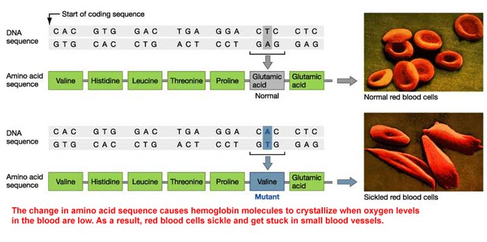 what-causes-sickle-cell-disease-sickle-cell-dna